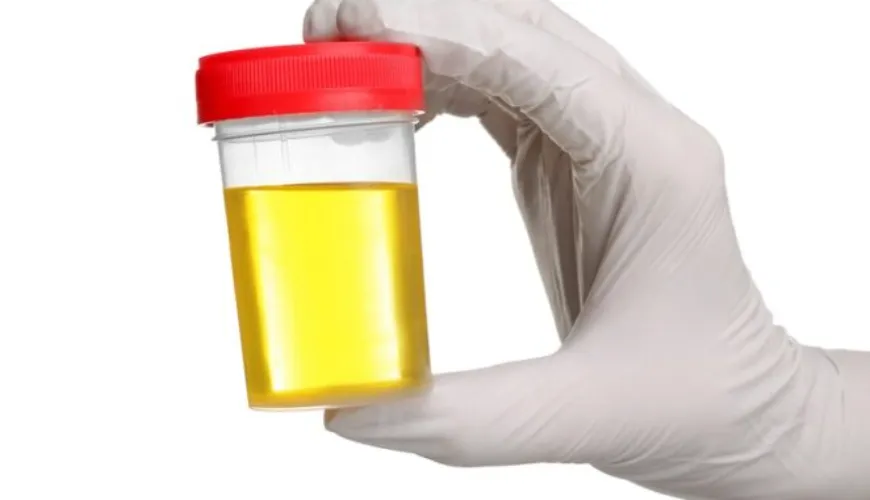 Comment éviter les infections des voies urinaires et les bactéries dans l'urine ?